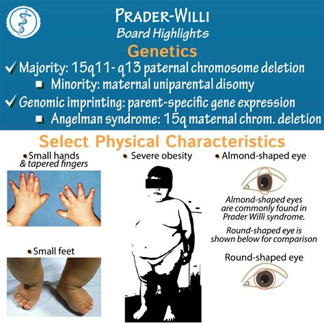 willi prada syndrome|prader willi syndrome in adults.